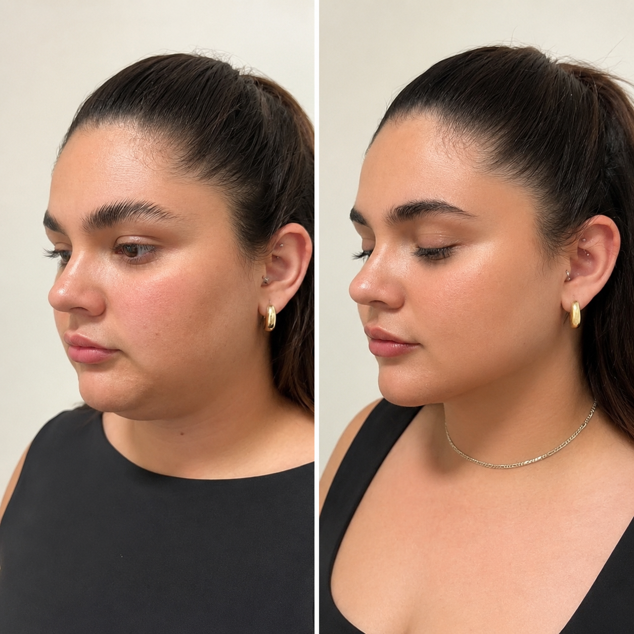 Face Lifting Result